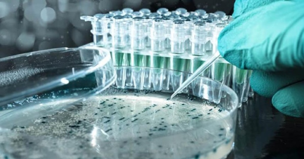 Môi trường nuôi cấy vi sinh vật dạng lỏng dùng chủ yếu để nhân giống vi sinh vật với số lượng lớn