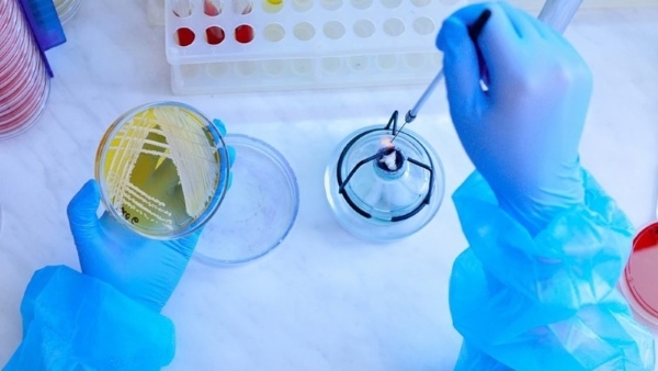 Phương pháp cấy phân vùng giúp phân lập vi khuẩn thành các khuẩn lạc riêng lẻ, thuận tiện xác định tác nhân gây bệnh