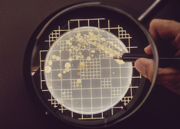 Có 03 phương pháp xác định CFU phổ biến trong kiểm nghiệm vi sinh