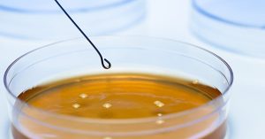 Khuẩn lạc vi sinh vật trên đĩa thạch Petri với hình thái điển hình