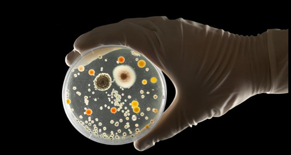 Hình ảnh minh họa khuẩn lạc trong vi sinh học