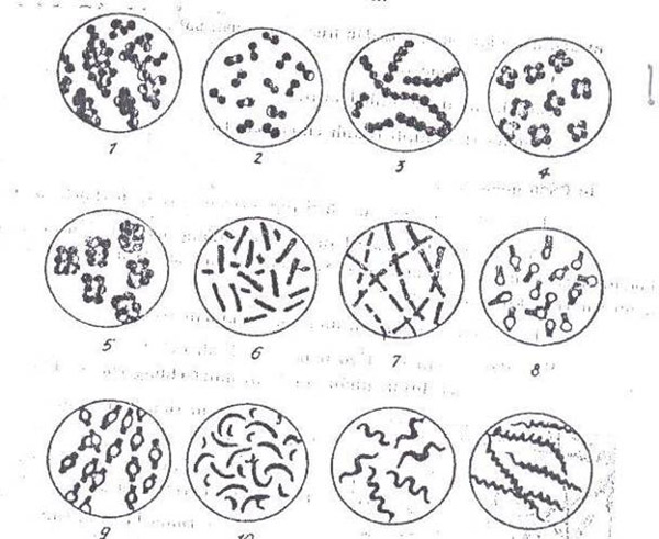 Các hình thái của một số khuẩn lạc phổ biến