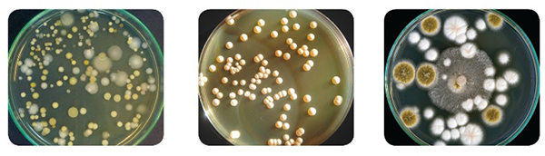 So sánh hình thái khuẩn lạc theo vi sinh vật bao gồm vi khuẩn, nấm men và nấm mốc