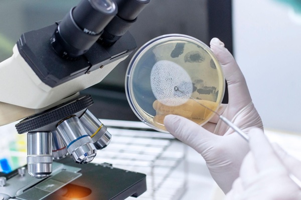 Ứng dụng công nghệ vi sinh vật để thu hoạch nguồn enzyme tự nhiên năng suất cao